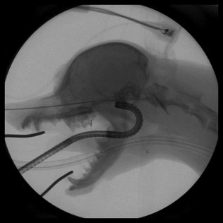 Nasopharyngeal stent Nasopharyngeal stent